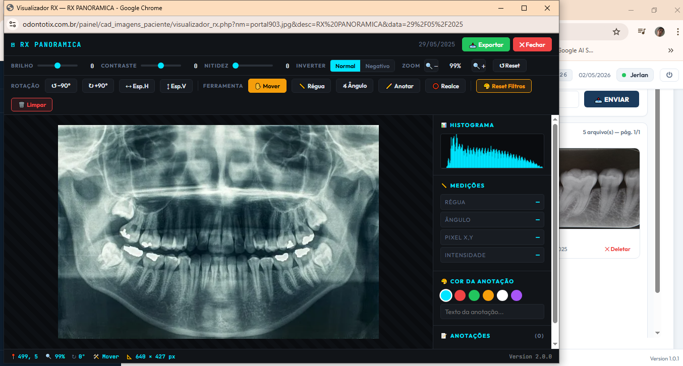 Visualizador RX
